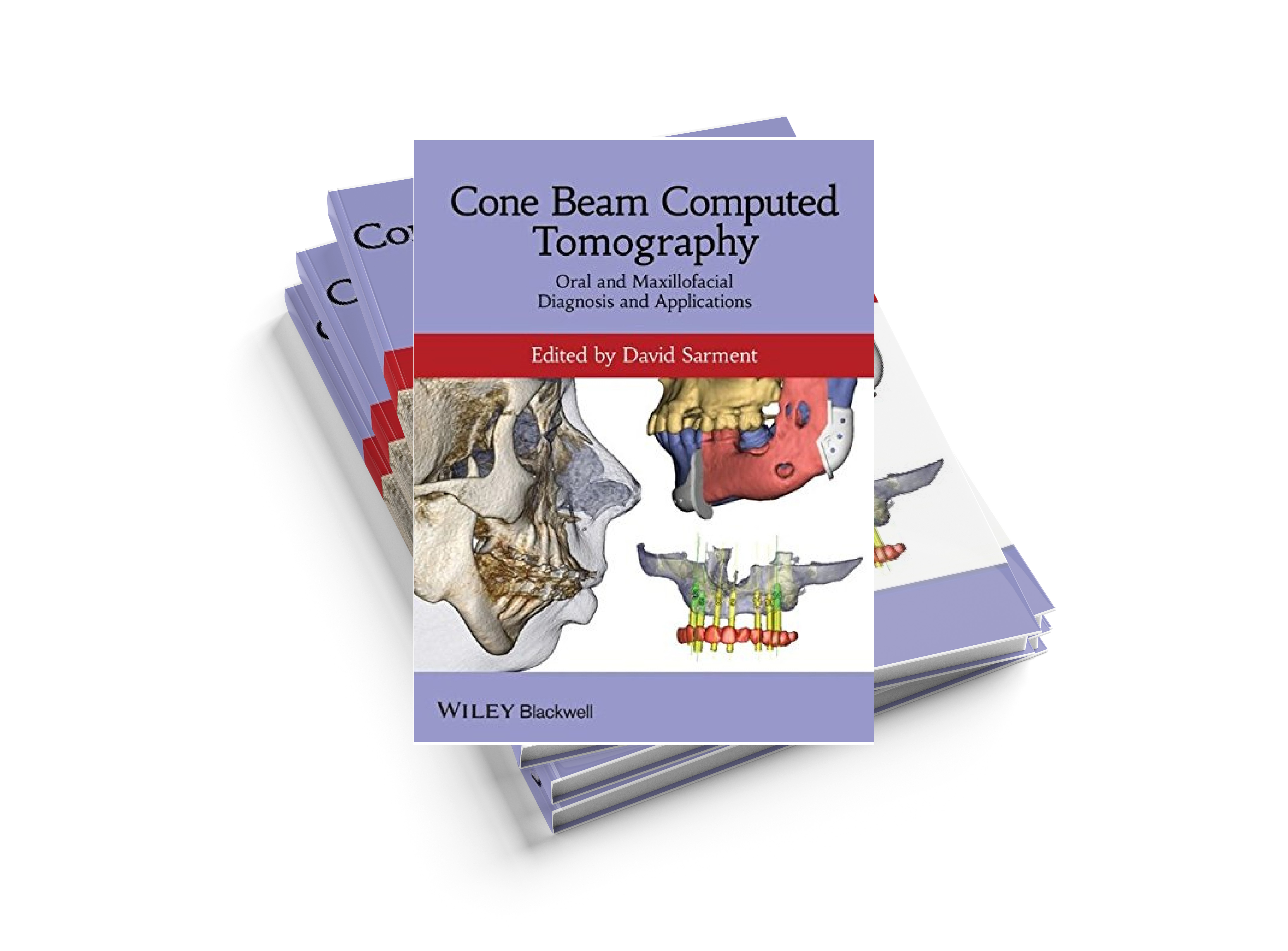 Cone Beam Computed Tomography: Oral and Maxillofacial Diagnosis and Applications 1st Edition by David Sarment (Editor)